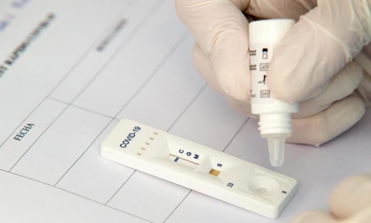 Cinfa distribuirá el primer test de antígenos de autodiagnóstico Covid-19 sin receta en las farmacias