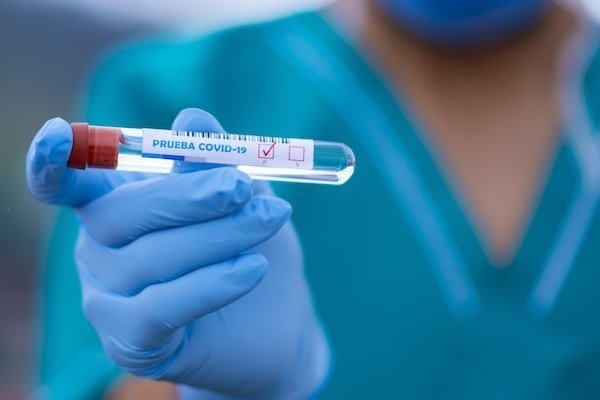 Investigadores aconsejan dejar pasar 15 días para repetir el test del coronavirus
